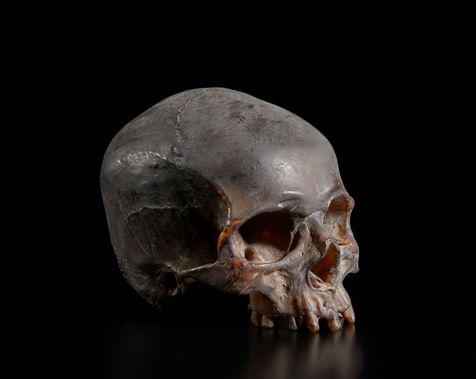 . A real size wax model of a human skull .. Modelo en cera a tamaño real de un c&hellip;