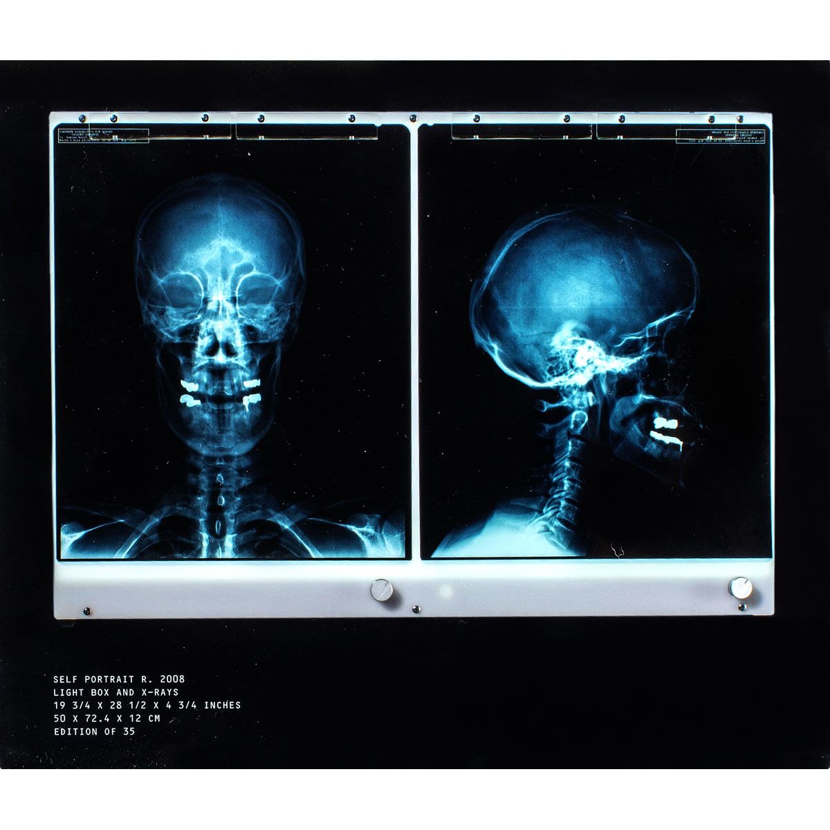 Null Damien HIRST, Britannique, né en 1965

X-Ray Self Portrait, 2008

Radiograp&hellip;