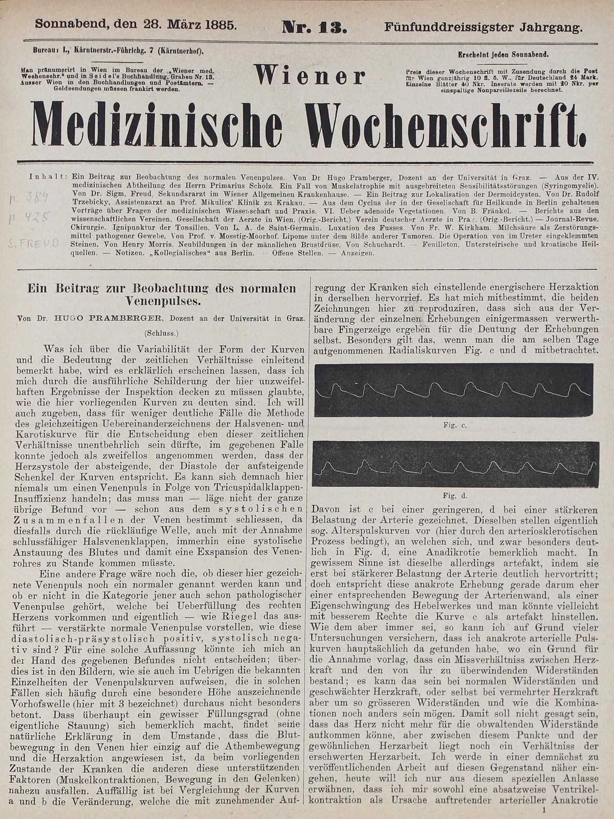 Freud,S. Un cas d'atrophie musculaire avec troubles étendus de la sensibilité (s&hellip;