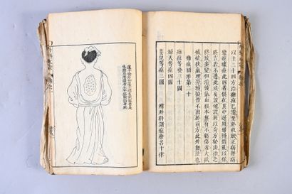 CHINE, XVIIIe siècle Ouvrage d'acupuncture