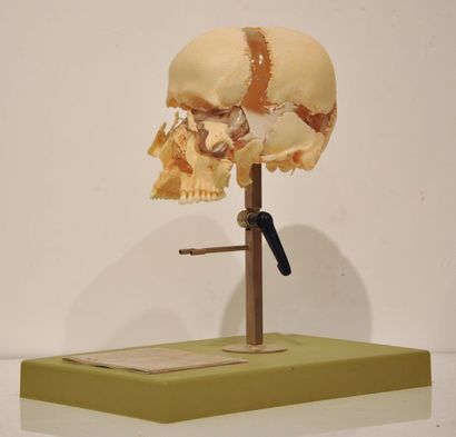 null SOMSO

Crâne humain artificiel éclaté en résine reposant sur une base plastique.

H....