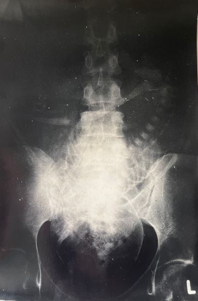 null Radiograph

Basin, c. 1980

Vintage silver print, stamped on the back

29 x...
