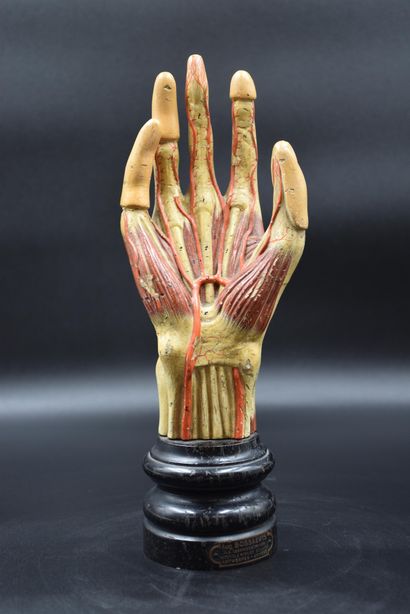 null Didactic skinning: hand in patinated plaster. End of the XIXth century, maker's...