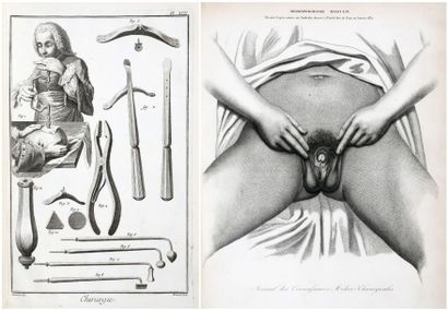 null [ANATOMIE-CHIRURGIE] [ENCYCLOPÉDIE DE DIDEROT & D'ALEMBERT]. [Recueil de planches,...