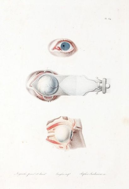 DEMOURS (Antoine-Pierre), LAGUICHE (C.B.L.) [Atlas du Traité des maladies des yeux]....
