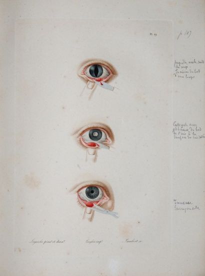 DEMOURS (Antoine-Pierre) Traité des maladies des yeux. Paris, L'auteur, imprimerie...