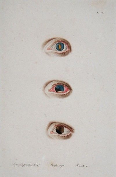DEMOURS (Antoine-Pierre) Traité des maladies des yeux. Paris, L'auteur, imprimerie...