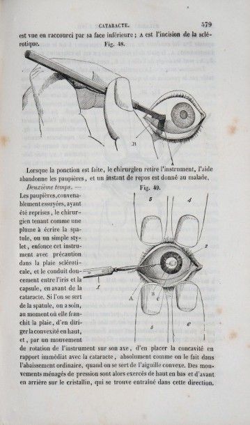 DESMARRES (Louis-Auguste) Traité théorique et pratique des maladies des yeux. Paris,...