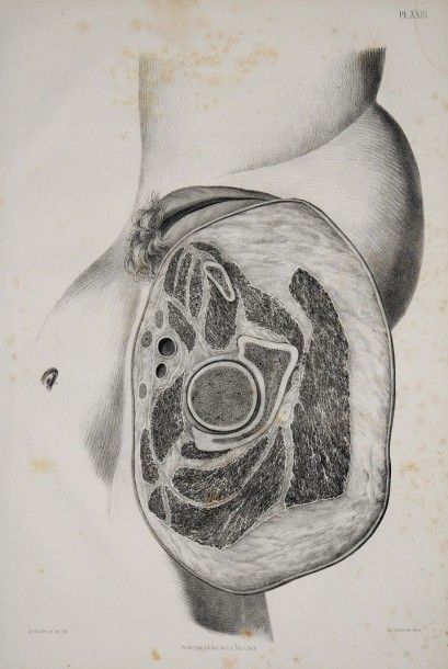 LE GENDRE (Eugène Quintien) Anatomie chirurgicale homalographique, ou Description...