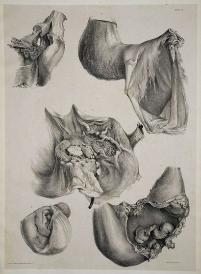 null [Anatomie]. Second (the) fascicule of anatomical drawings, selected from the...