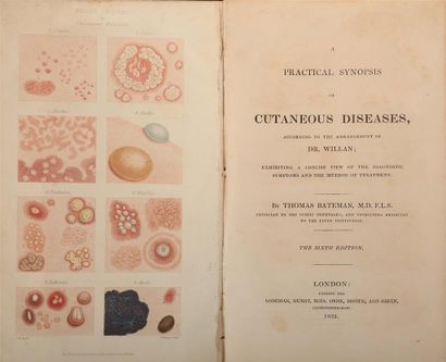null BATEMAN (Thomas). A practical synopsis of Cutaneous Diseases, according to the...