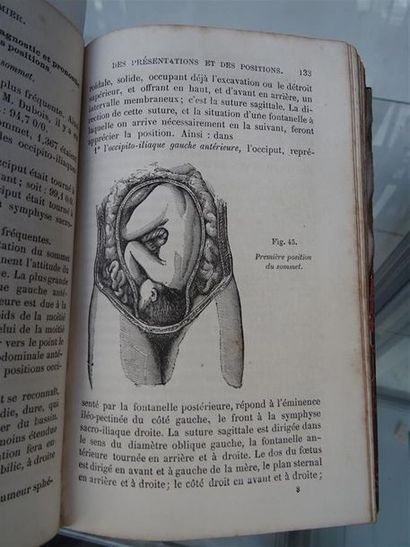 null VERRIER (Eugène) - Manuel pratique de l'art des accouchements Paris, Savy, 1867...