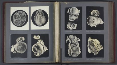 [Photographie scientifique] [Macrophotographie] Henri BELLIENI (1857-1938) à Nancy,...