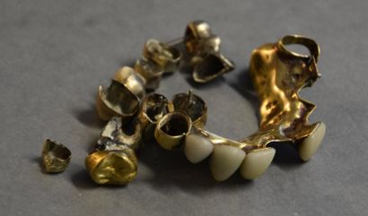 Bijoux - Joaillerie Lot de débris dentaire en or jaune 14K (585/°°) Poids brut :...