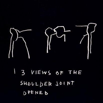Jean-Michel BASQUIAT (1960-1988) 3 Views of the shoulder joint opened, 1982
Sérigraphie,...