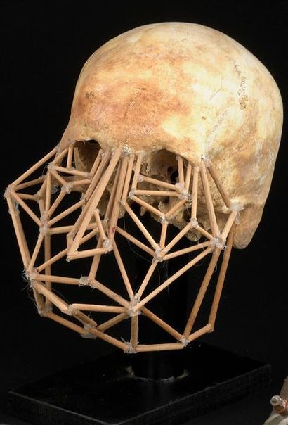 Michel ANDRAULT (né en 1926) Prothèse du visage
Os et baguettes de bois
H. 20 cm
(Reproduit...