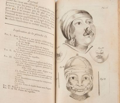null DESAULT (Pierre-Joseph). Journal de chirurgie. A Paris, s.n., 1791-1792-[1795]....
