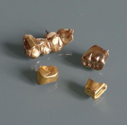 null Ensemble de dents gainées d'or et bidges en or
Poids brut total : 20,6 g.
