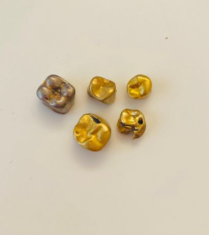 null A SET of 14K (585°/oo) dental gold fragments.

Gross weight : 7,3 g