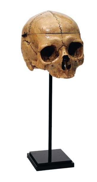 null Crâne humain «Cross blade skull». Sur socle. XIXe siècle. H_39 cm