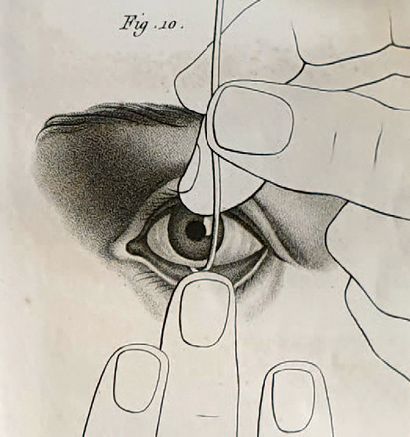 OPHTALMOLOGIE. — HAZARD-MIRAULT Practical treatment of the artificial eye. Paris,...