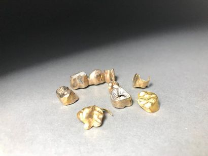 Ensemble de 9 dents en or 26.38g