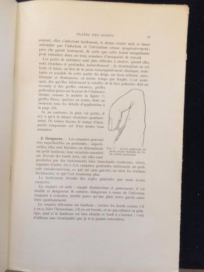 null MÉDECINE DE LA MAIN.
Ensemble 2 ouvrages.
BELL. The Hand, its mechanism and...