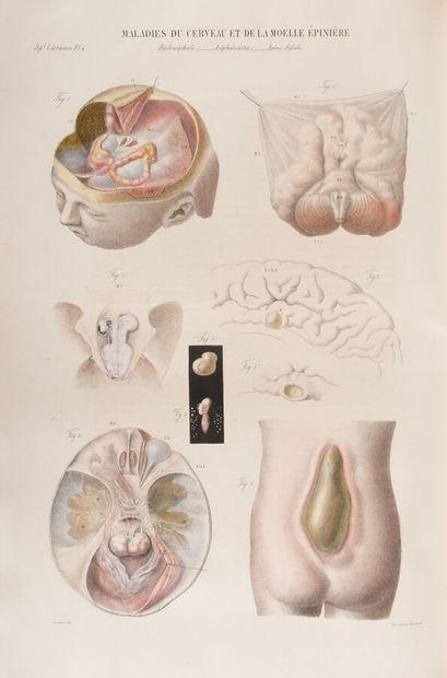 null CRUVEILHIER (Jean)

Anatomie Pathologique du Corps Humain, ou Description, avec...
