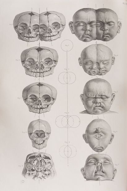 null MACLISE (Joseph)

Surgical Anatomy. London, Churchill, 1851.

In plano: 5f....