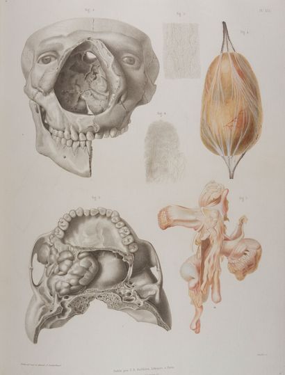 null LEBERT (Hermann)

Traité d'Anatomie Pathologique générale et spéciale, ou Description...