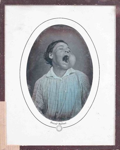 null Louis-Auguste BISSON (1814-1876). Homme à la joue gonflée (de face, bouche ouverte)....