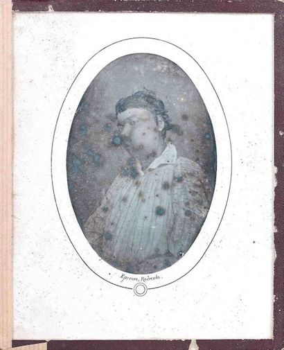 null Louis-Auguste BISSON (1814-1876). Homme à la joue gonflée (de profil). 1er août...