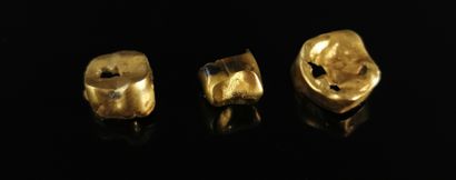 null Trois débris d'or dentaire, dont un avec amalgame.

5,64 grammes, 18K, 750°...