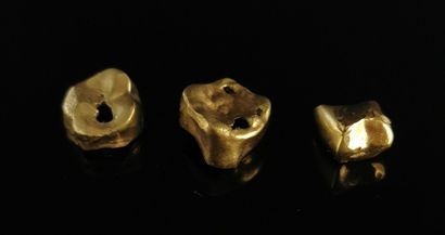 null Trois débris d'or dentaire, dont un avec amalgame.

5,64 grammes, 18K, 750°...