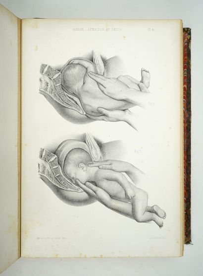 null LENOIR (A.) : Atlas de l'art des accouchements. Continué par Marc Sée [et] S....