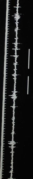 null ELECTROCARDIOGRAMME (sur le thème de). Ensemble de dix tirages argentiques en...