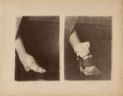null William SAUNDERS (1832-1892)

Pieds bandés de femme, Chine, c. 1870-1880

2...