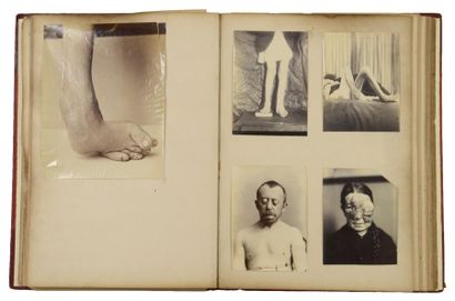 null "Photographs of Hospital Patients"

Médecine : photographies (26) et radiographies...
