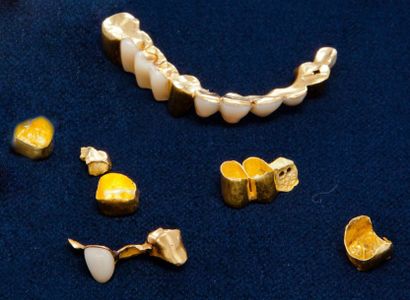 null Débris dentaire en or , poids brut 34g