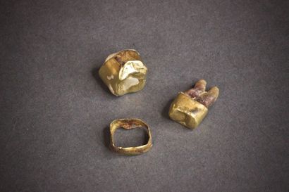 null débris d'or dentaire 4,5 g brut