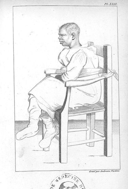null "AMBROISE TARDIEU: DESSINS D'ALIÉNÉS AMBROISE TARDIEU (1788-1841) Des maladies...