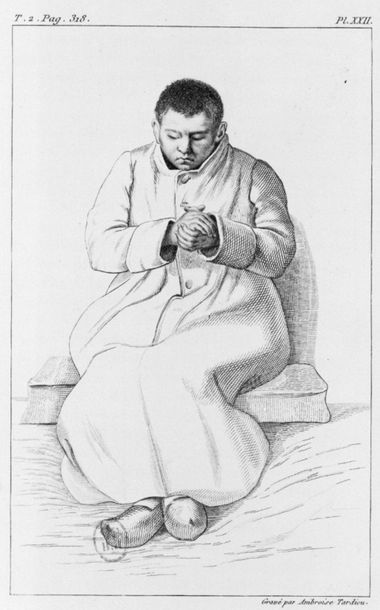 null "AMBROISE TARDIEU: DESSINS D'ALIÉNÉS AMBROISE TARDIEU (1788-1841) Des maladies...