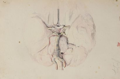 null [MANUSCRIT] - LANCEREAUX, Etienne & LACKERBAUER, Pierre - Atlas d'anatomie pathologique....