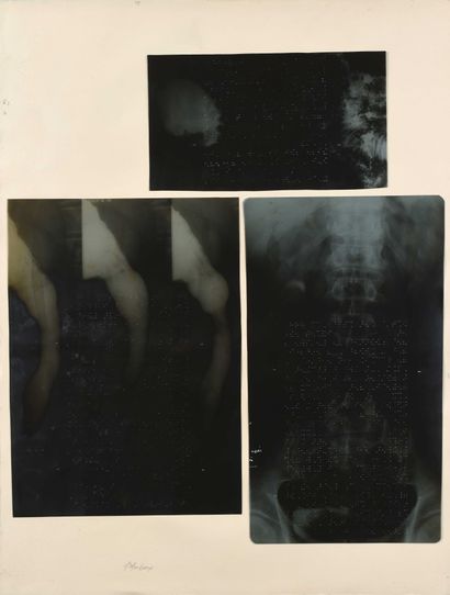 null Bruno MENDONCA (1953 2011) X-ray prints. pasted on paper, the embossing forming...