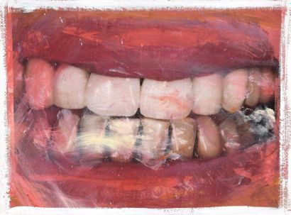 Philippe PASQUA (né en 1965) Dents, 1998 (dents n°8, 13, 20 et 17)
Suite de quatre...