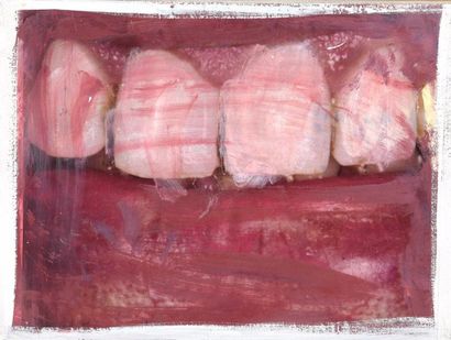Philippe PASQUA (né en 1965) Dents, 1998 (dents n°3, 14, 15 et 16)
Suite de quatre...