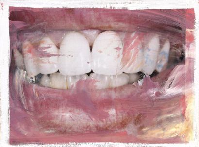 Philippe PASQUA (né en 1965) Dents, 1998 (dents n°1 et 11)
Suite de deux techniques...