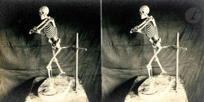 null Unidentified photographer 
Skeleton with a
 baseball bat, c. 1910. 

Stereocopic...