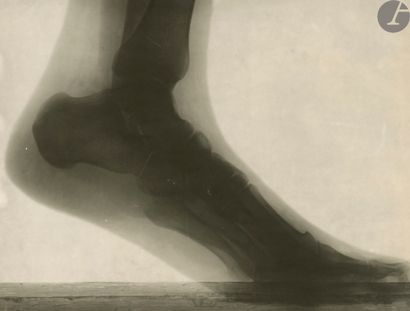 null Jacques Boyer (1869-1960)
Radiographies de pied (avec et sans chaussure), c....