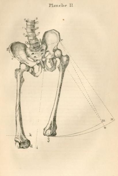 null PIGEOLET (A.V). Études sur la maladie de la hanche. Brux., Tircher, 1845, 8°,...
